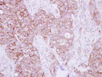 Immunohistochemistry-Paraffin: TBRG4 Antibody [NBP2-20582]