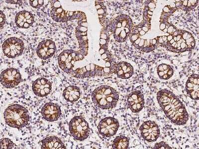 Immunohistochemistry-Paraffin: TBRG4 Antibody [NBP2-98536]