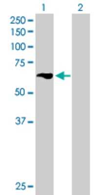 Western Blot: TBRG4 Antibody [H00009238-B01P]
