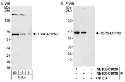 Western Blot: TBRG4 Antibody [NB100-61629]