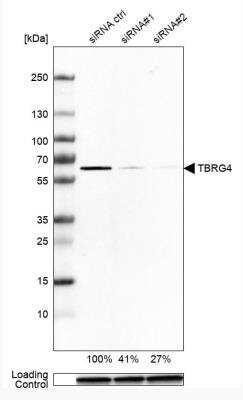 Western Blot: TBRG4 Antibody [NBP1-85478]