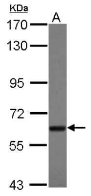 Western Blot: TBRG4 Antibody [NBP2-20582]