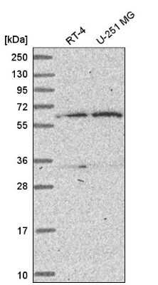 Western Blot: TBRG4 Antibody [NBP2-58726]