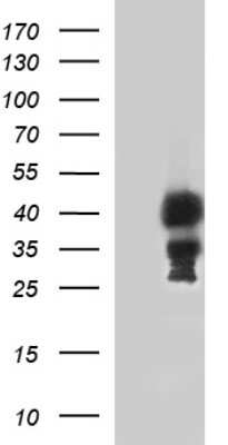 Western Blot: TBX1 Antibody (OTI1C2) [NBP2-46076]