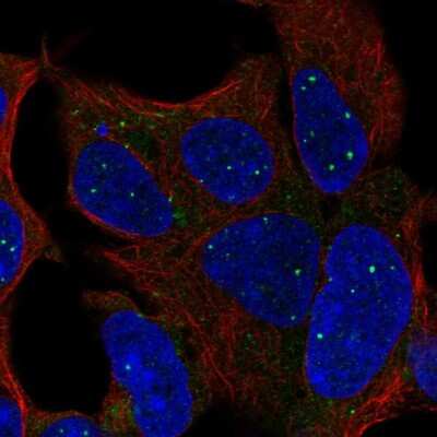 Immunocytochemistry/ Immunofluorescence: TBX1 Antibody [NBP2-56667]