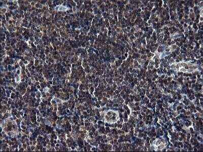Immunohistochemistry: TBX1 Antibody (OTI1C2) - Azide and BSA Free [NBP2-74470]