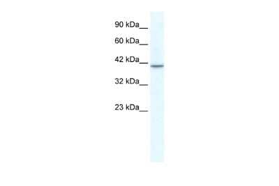 Western Blot: TBX1 Antibody [NBP2-85884]