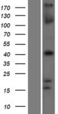 Western Blot: TBX1 Overexpression Lysate [NBP2-05770]