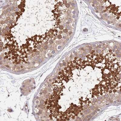 Immunohistochemistry-Paraffin: TBX10 Antibody [NBP2-13417]