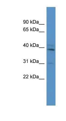 Western Blot: TBX10 Antibody [NBP1-68982]