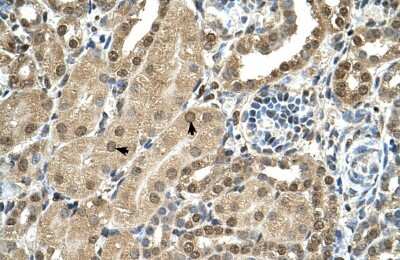 Immunohistochemistry: TBX15 Antibody [NBP2-83624]