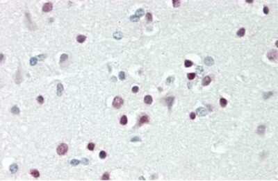 Immunohistochemistry: TBX15 Antibody [NBP2-83624]