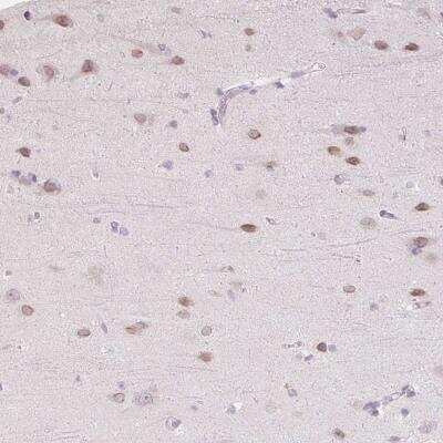 Immunohistochemistry-Paraffin: TBX15 Antibody [NBP2-49036]