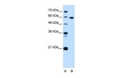 Western Blot: TBX15 Antibody [NBP2-83624]