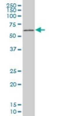 Western Blot: TBX18 Antibody (3C12) [H00009096-M04]