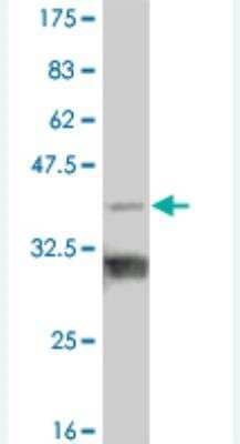 Western Blot: TBX18 Antibody (3D9) [H00009096-M01]