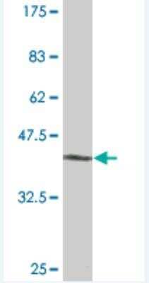 Western Blot: TBX18 Antibody (3G2) [H00009096-M08]