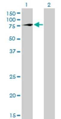 Western Blot: TBX2 Antibody (7G5) [H00006909-M01]