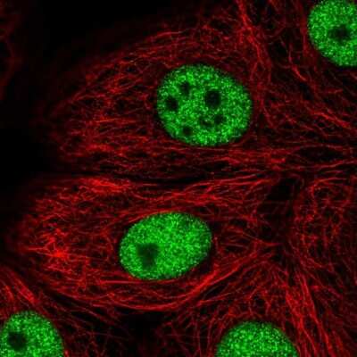 Immunocytochemistry/ Immunofluorescence: TBX2 Antibody [NBP1-89459]