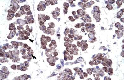 Immunohistochemistry: TBX20 Antibody [NBP2-86846]