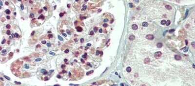 Immunohistochemistry: TBX20 Antibody [NBP2-86846]