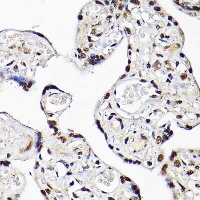 Immunohistochemistry-Paraffin: TBX20 Antibody - Azide and BSA Free [NBP2-93256]