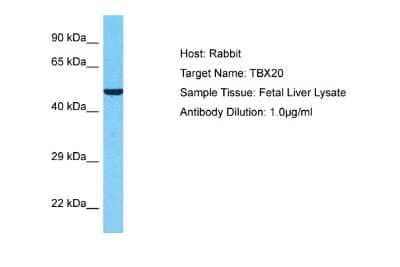 Western Blot: TBX20 Antibody [NBP2-86845]