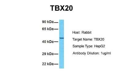 Western Blot: TBX20 Antibody [NBP2-86846]