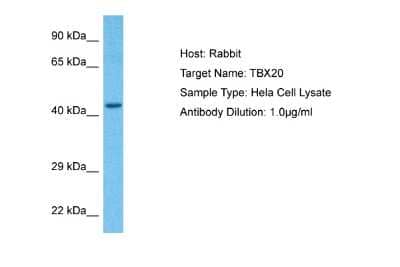 Western Blot: TBX20 Antibody [NBP2-86846]