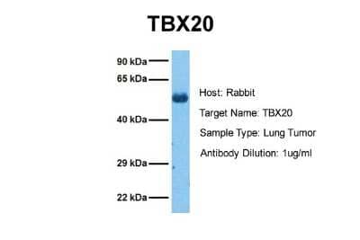 Western Blot: TBX20 Antibody [NBP2-86847]