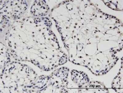 Immunohistochemistry-Paraffin: TBX22 Antibody (1A10) [H00050945-M01]