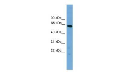 Western Blot: TBX22 Antibody [NBP2-86851]