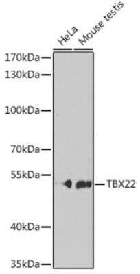 Western Blot: TBX22 AntibodyBSA Free [NBP2-94171]