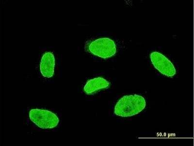 Immunocytochemistry/ Immunofluorescence: TBX3 Antibody (7B3) [H00006926-M08]