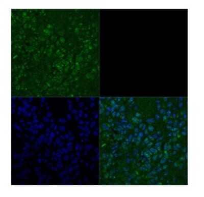 Immunohistochemistry: TBX3 Antibody [NBP3-10971]