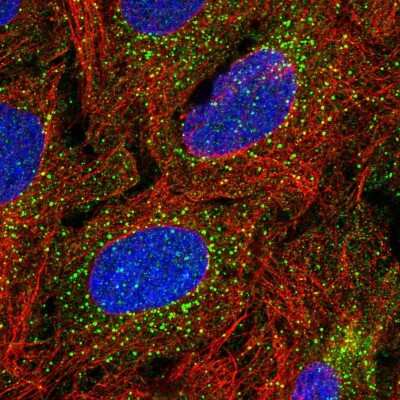 Immunocytochemistry/ Immunofluorescence: TBX4 Antibody [NBP2-58490]