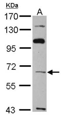 Western Blot: TBX4 Antibody [NBP1-32879]