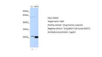 Western Blot: TBX4 Antibody [NBP2-85889]