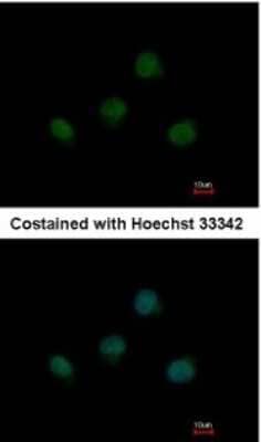 Immunocytochemistry/ Immunofluorescence: TBX5 Antibody [NBP1-33715]