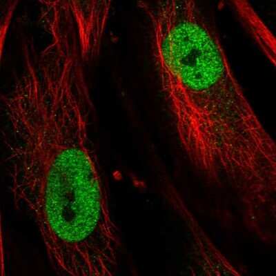 Immunocytochemistry/ Immunofluorescence: TBX5 Antibody [NBP2-55931]