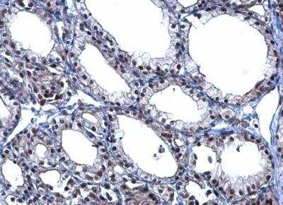 Immunohistochemistry-Paraffin: TBX5 Antibody [NBP1-33715]