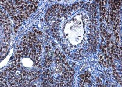 Immunohistochemistry-Paraffin: TBX5 Antibody [NBP1-33715]