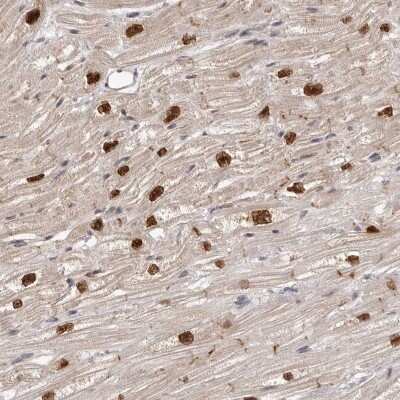 Immunohistochemistry-Paraffin: TBX5 Antibody [NBP1-83237]