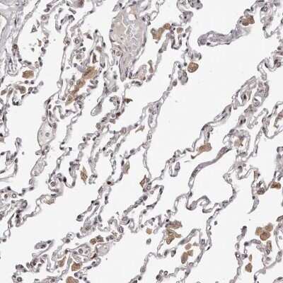 Immunohistochemistry-Paraffin: TBX5 Antibody [NBP1-83237]