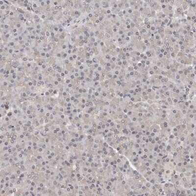 Immunohistochemistry-Paraffin: TBX5 Antibody [NBP1-83237]