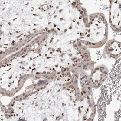 Immunohistochemistry-Paraffin: TBX5 Antibody [NBP1-83237]