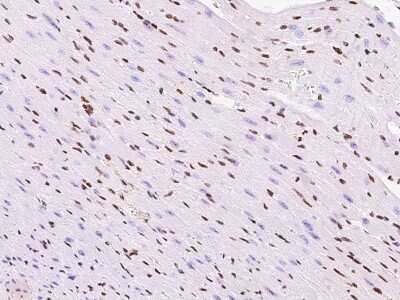 Immunohistochemistry-Paraffin: TBX5 Antibody [NBP2-99529]