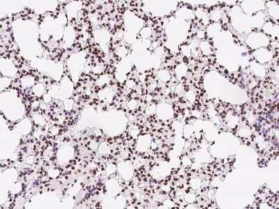 Immunohistochemistry-Paraffin: TBX5 Antibody [NBP2-99529]