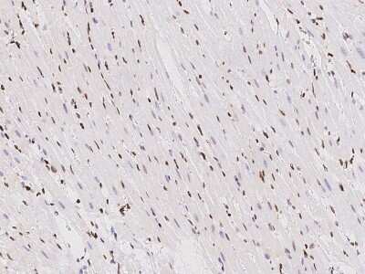 Immunohistochemistry-Paraffin: TBX5 Antibody [NBP2-99529]