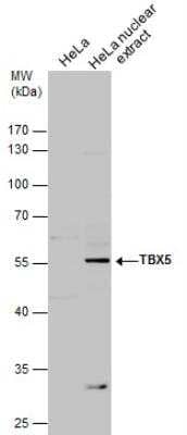 Western Blot: TBX5 Antibody [NBP1-33715]